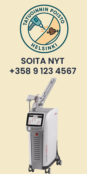 Tatuoinninpoisto Helsinki
