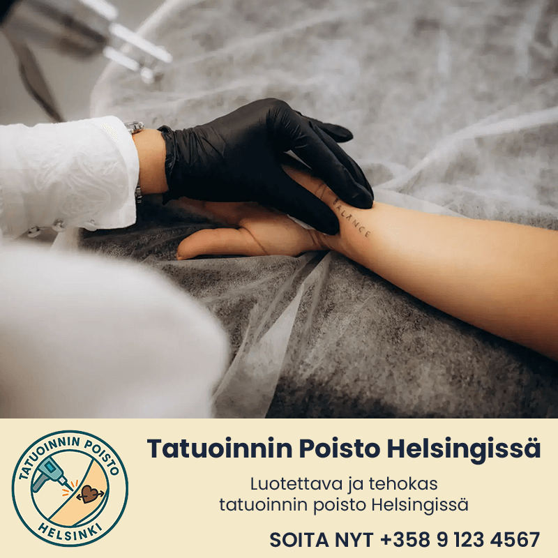 Tatuoinnin Poisto Helsingissä